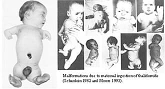 Grünenthal suppressed reports that thalidomide caused birth defects, bribed doctors, and pressured journals — deforming 10,000+ babies — documented evidence