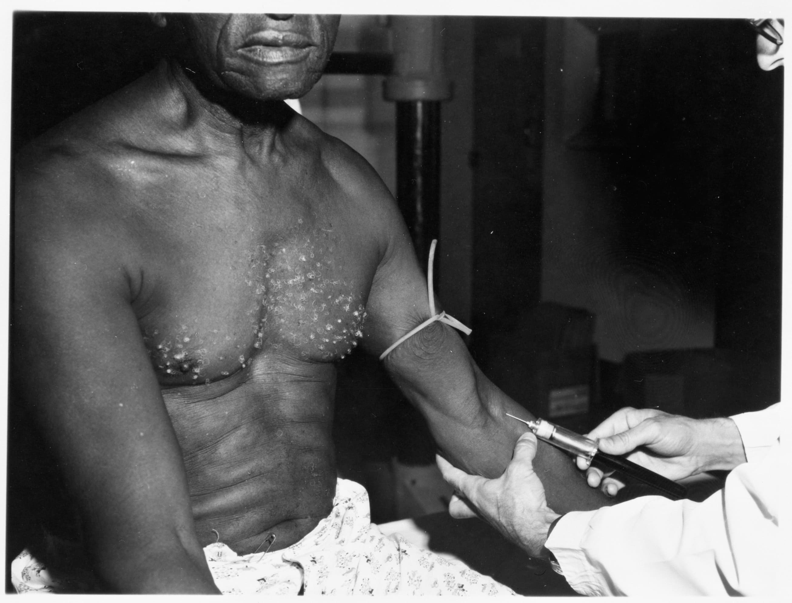 Tuskegee Syphilis Study let Black men die untreated to observe disease progression — documented evidence